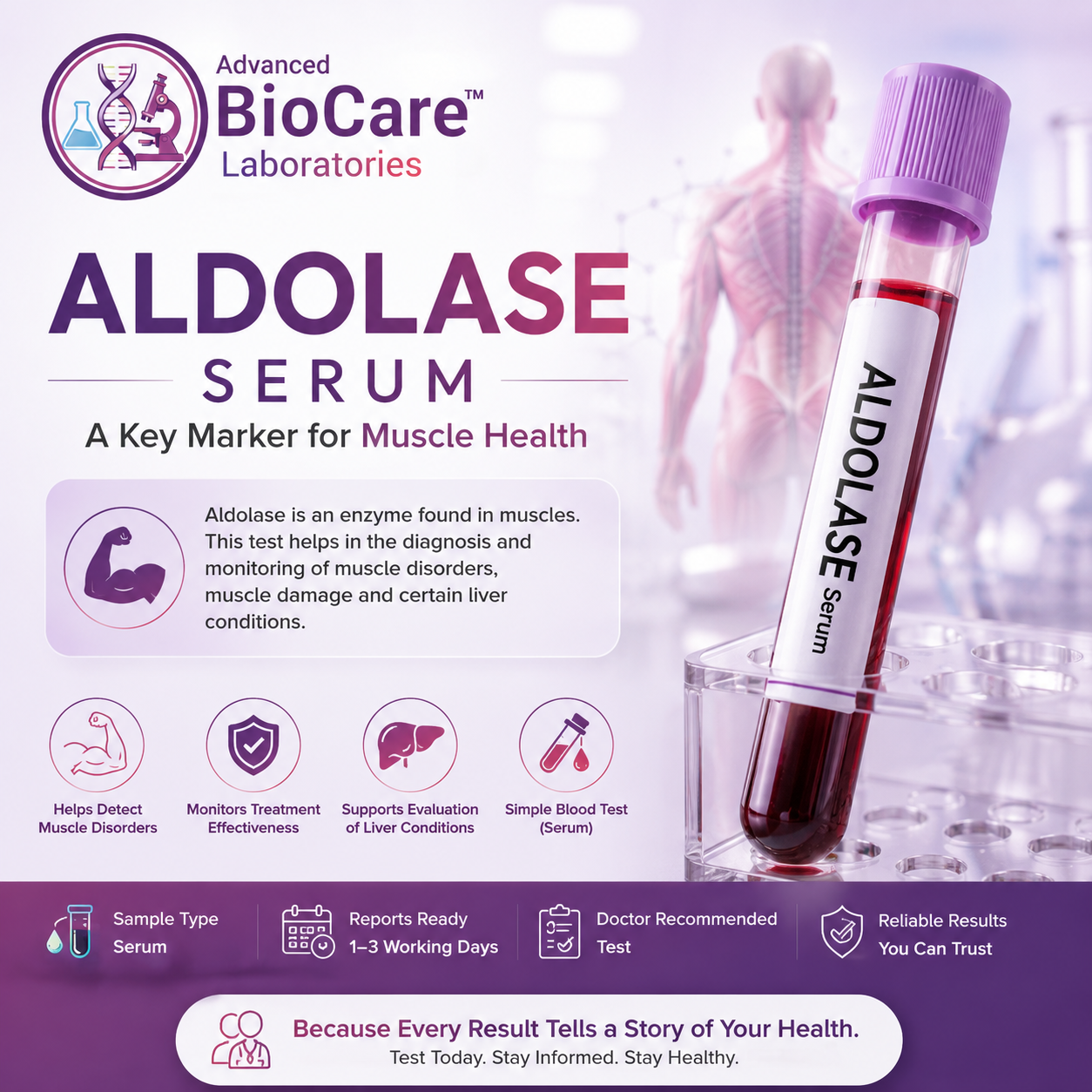 Aldolase, serum