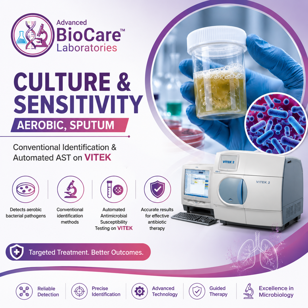 Culture & Sensitivity, Aerobic, Sputum- Conventional Identification & Automated AST on Vitek