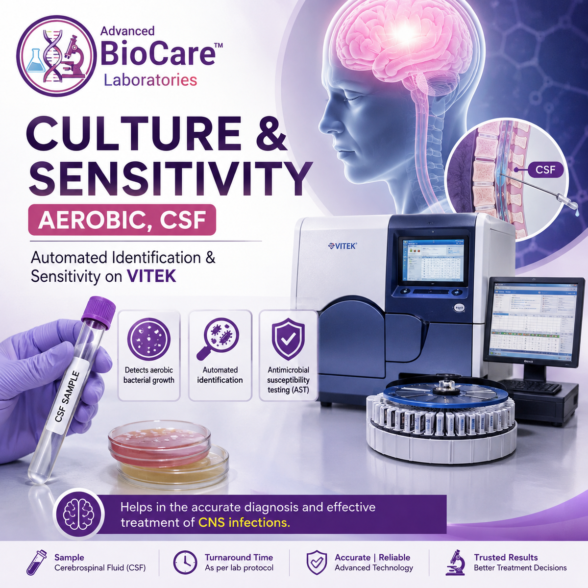 Culture & Sensitivity, Aerobic, CSF- Automated Identification & Sensitivity on Vitek