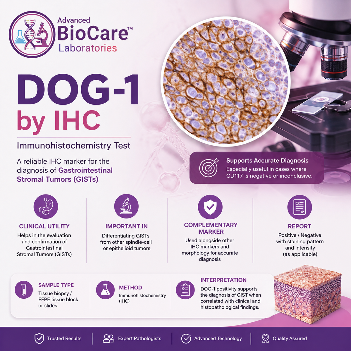 DOG-1 by IHC