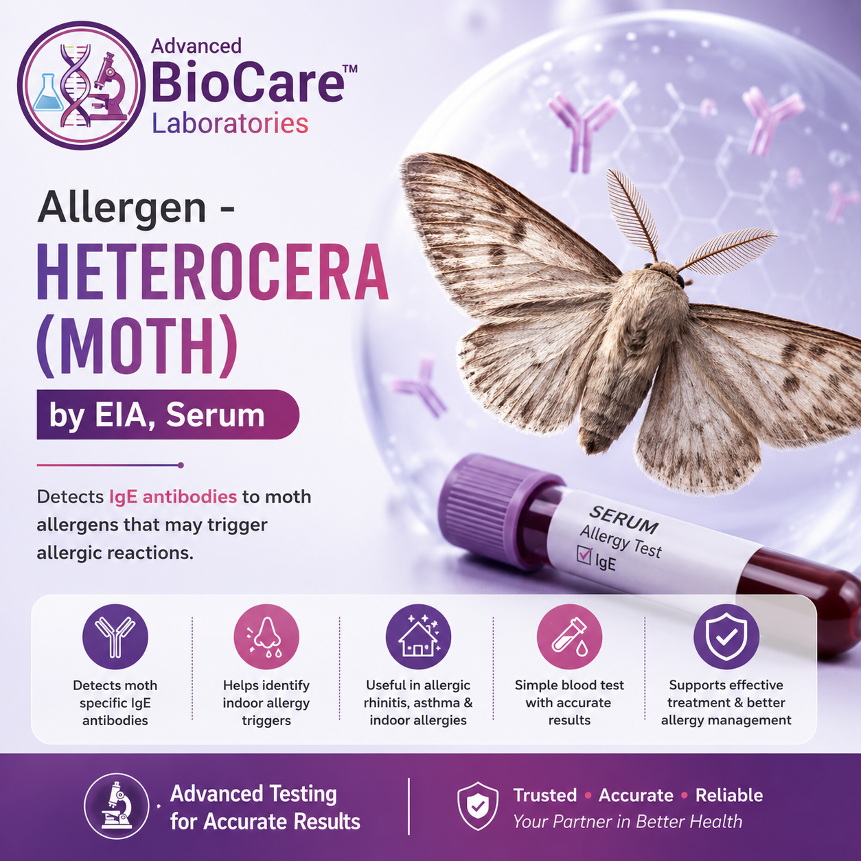 Allergen - HETEROCERA (MOTH) by EIA, Serum