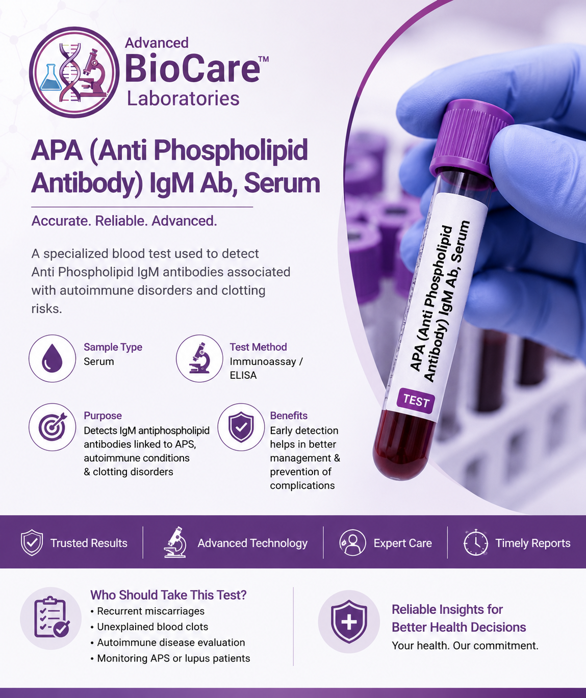 APA (Anti Phospholipid Antibody) IgM Ab, Serum