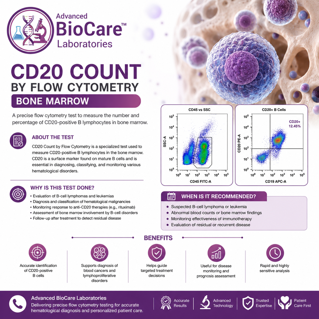 CD20 Count by Flowcytometry...