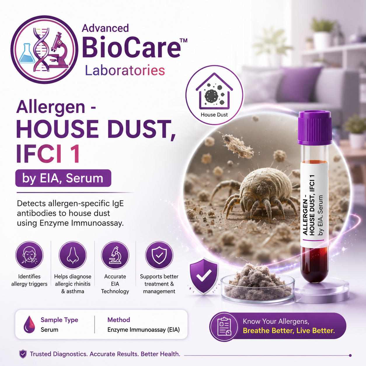 Allergen - HOUSE DUST ,  IFCI 1 by EIA, Serum