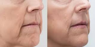 AnteAGE MD® Accelerator – Advanced Skin Renewal &amp; Barrier Defense
