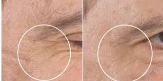 AnteAGE MD® Accelerator – Advanced Skin Renewal &amp; Barrier Defense
