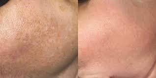 AnteAGE MD® Accelerator – Advanced Skin Renewal &amp; Barrier Defense
