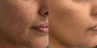 AnteAGE MD® Accelerator – Advanced Skin Renewal &amp; Barrier Defense