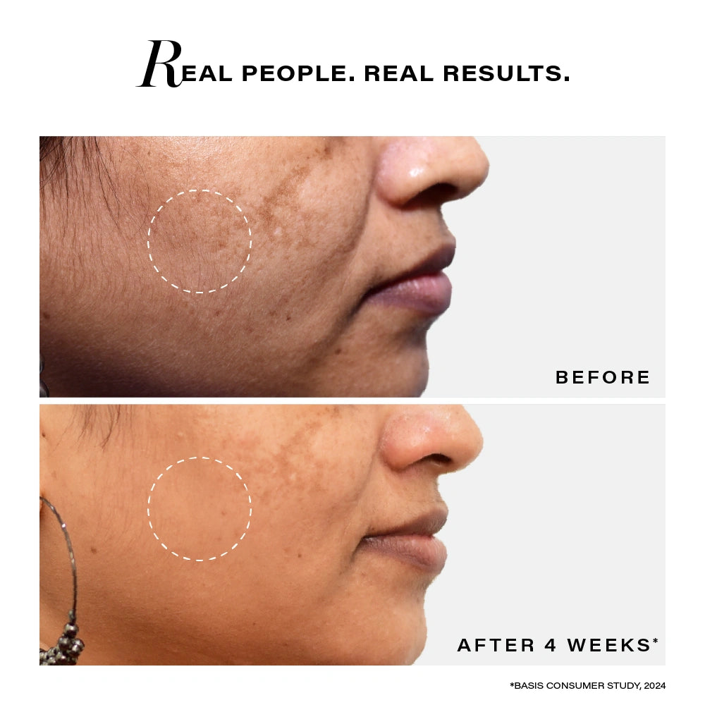 Novology Pigmentation Reduction Bi-phasic Serum
Novology