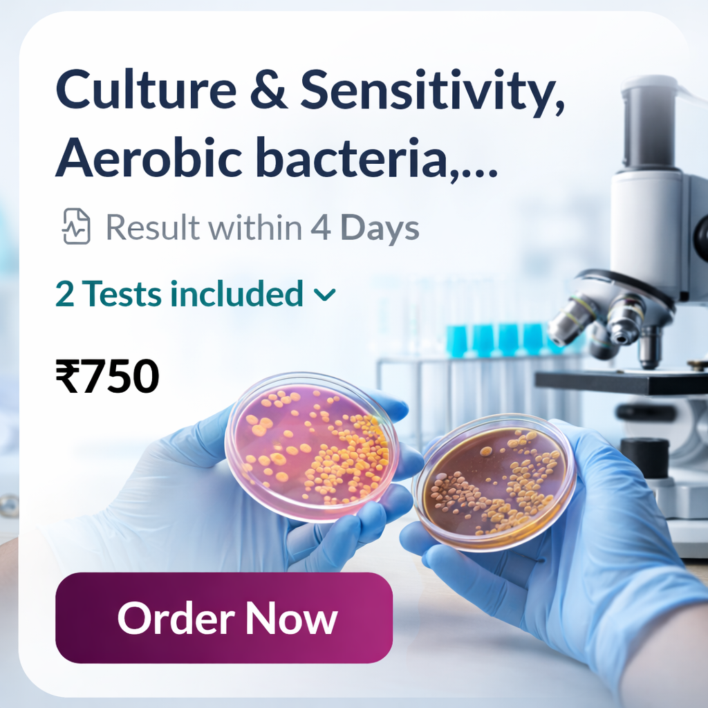 Culture & Sensitivity – Aerobic Bacteria (Urine)
